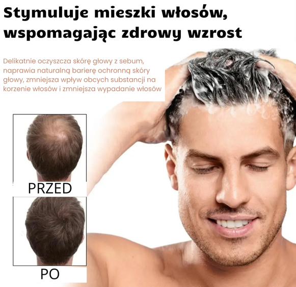 Szampon przeciw łysieniu zagęszczający, aktywujący cebulki włosów