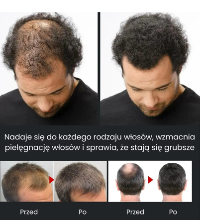 Szampon przeciw łysieniu zagęszczający, aktywujący cebulki włosów